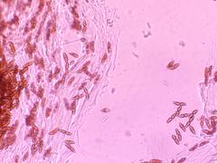 Gymnosporangium juniperi