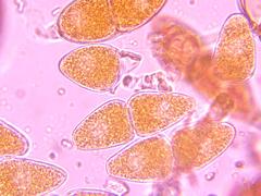 Gymnosporangium juniperi