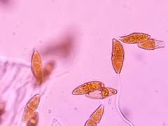 Gymnosporangium juniperi