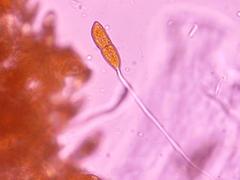 Gymnosporangium juniperi