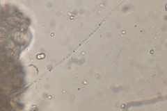 Oscillatoria redekei