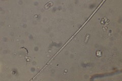 Oscillatoria redekei