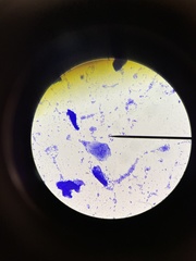 Bacillus