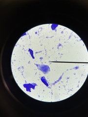 Bacillus