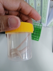 Ascaris lumbricoides