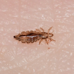 Pediculus humanus capitis
