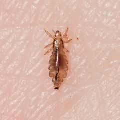 Pediculus humanus capitis