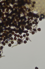 Fossombronia longiseta