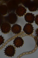 Fossombronia longiseta