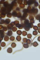 Fossombronia longiseta