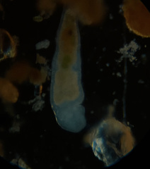 Stenostomum