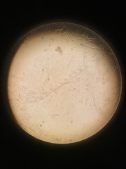 Pulvinula archeri