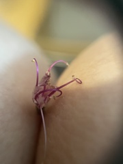 Collinsonia