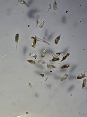 Pediculus humanus capitis