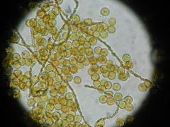 Perichaena quadrata