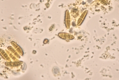 Arachnopeziza trabinelloides