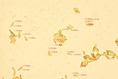 Arachnopeziza trabinelloides