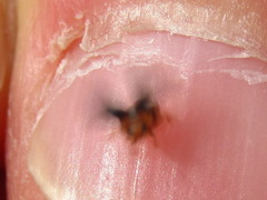 Scymnus ferrugatus