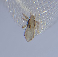 Pediculus humanus capitis