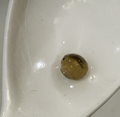 Gnorimosphaeroma noblei