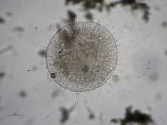 Actinosphaerium