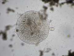 Actinosphaerium