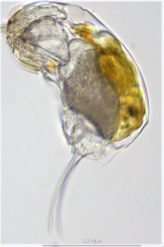 Cephalodella gibba