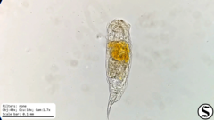 Cephalodella forficula