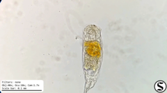 Cephalodella forficula