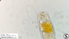 Cephalodella forficula