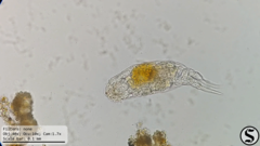 Cephalodella forficula