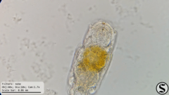 Cephalodella forficula