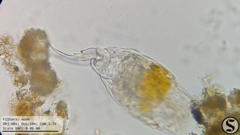 Cephalodella forficula