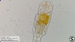 Cephalodella forficula