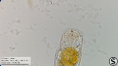 Cephalodella forficula