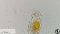 Cephalodella forficula