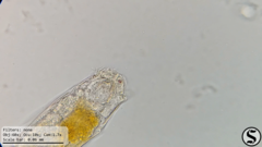 Cephalodella forficula