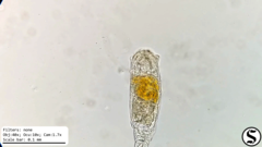 Cephalodella forficula