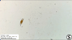 Cephalodella forficula