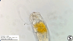 Cephalodella forficula