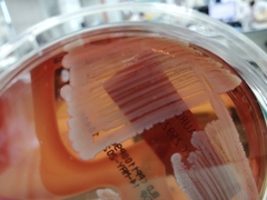 Staphylococcus aureus