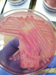 Escherichia coli