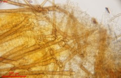 Cheilymenia stercorea