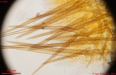 Cheilymenia stercorea