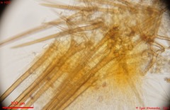 Cheilymenia stercorea