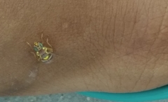 Bactrocera