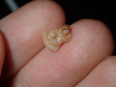 Petaloconchus caperatus