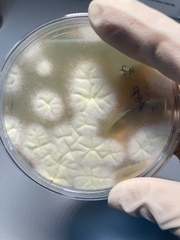 Aspergillus brasiliensis