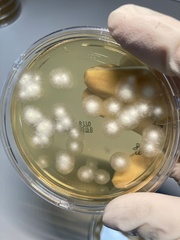 Aspergillus brasiliensis