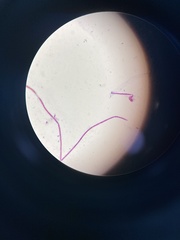 Aspergillus brasiliensis